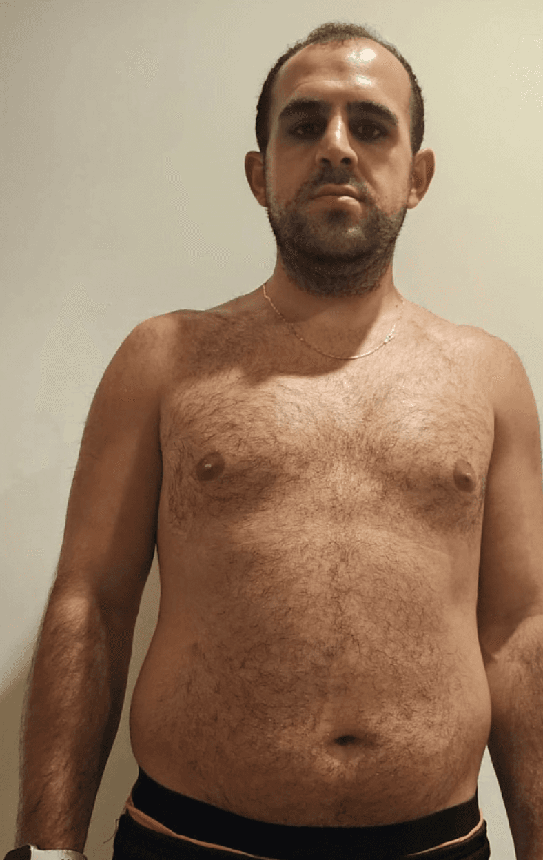 Elite Transformation 02 before transformation